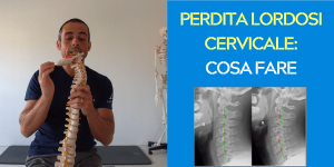 Perdita lordosi cervicale