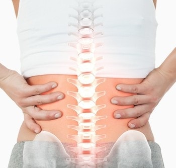 Trattamento chondrosis cervicale da punture