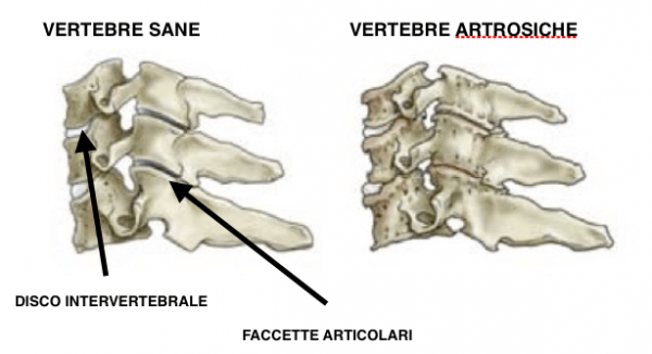 Come Si Chiama La Prima Vertebra Cervicale