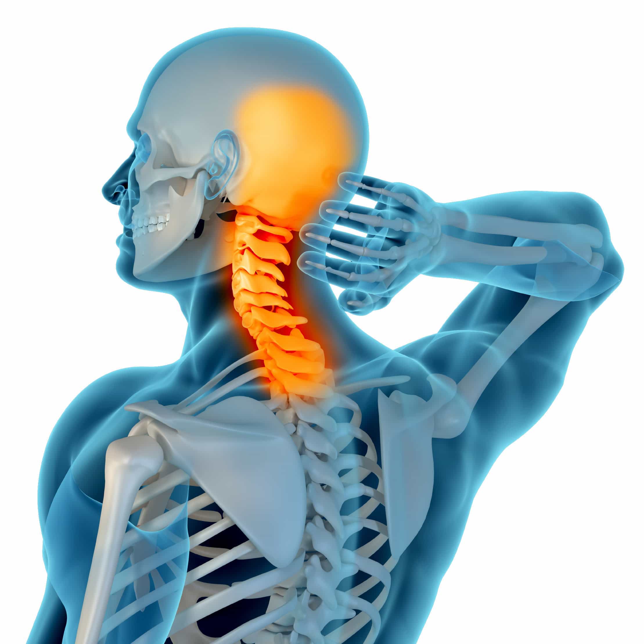 Neck Pain Anatomy