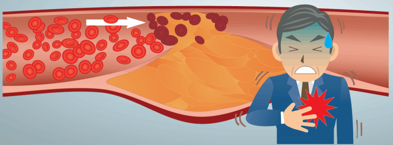 buona combinazione di cibi fluidificanti del sangue buona combinazione di cibi fluidificanti del sangue