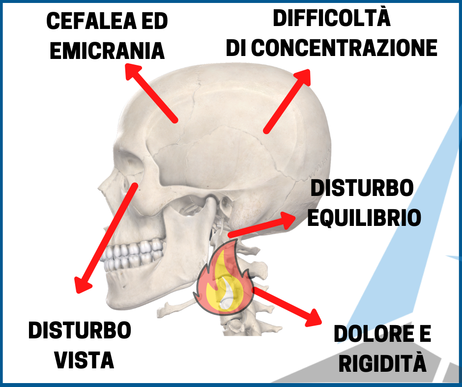 Cervicalgia e infiammazione cervicale: i 5 sintomi principali (+ altri)