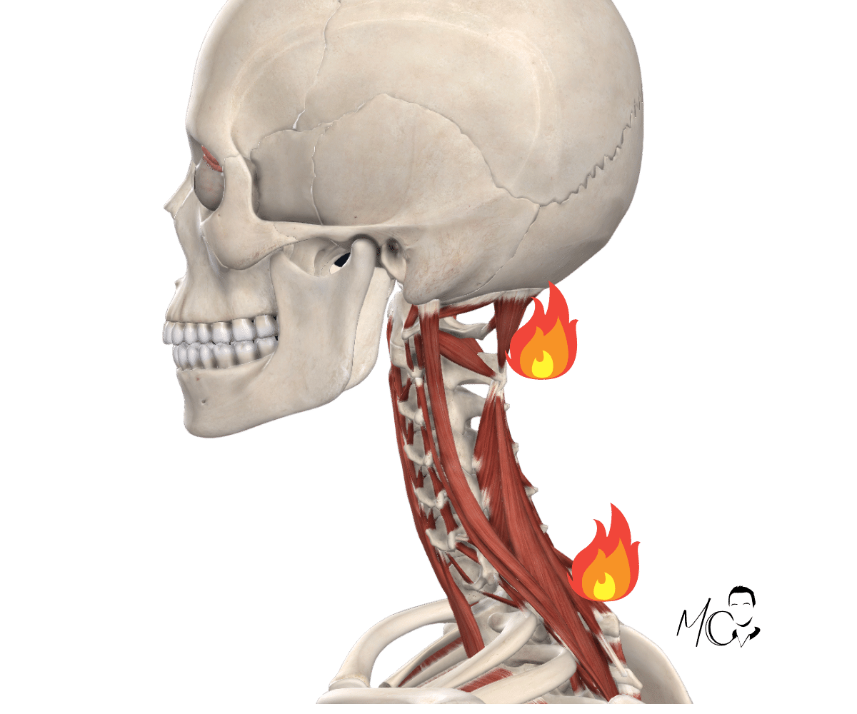 Cervicalgia e infiammazione cervicale: i 5 sintomi principali (+ altri)