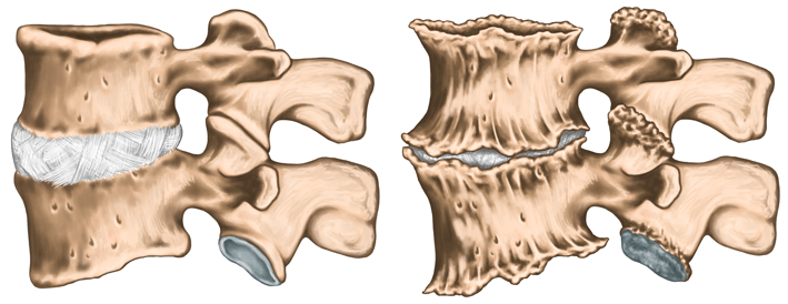 Vertebre cervicali