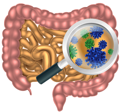 Colon irritabile e mal di schiena