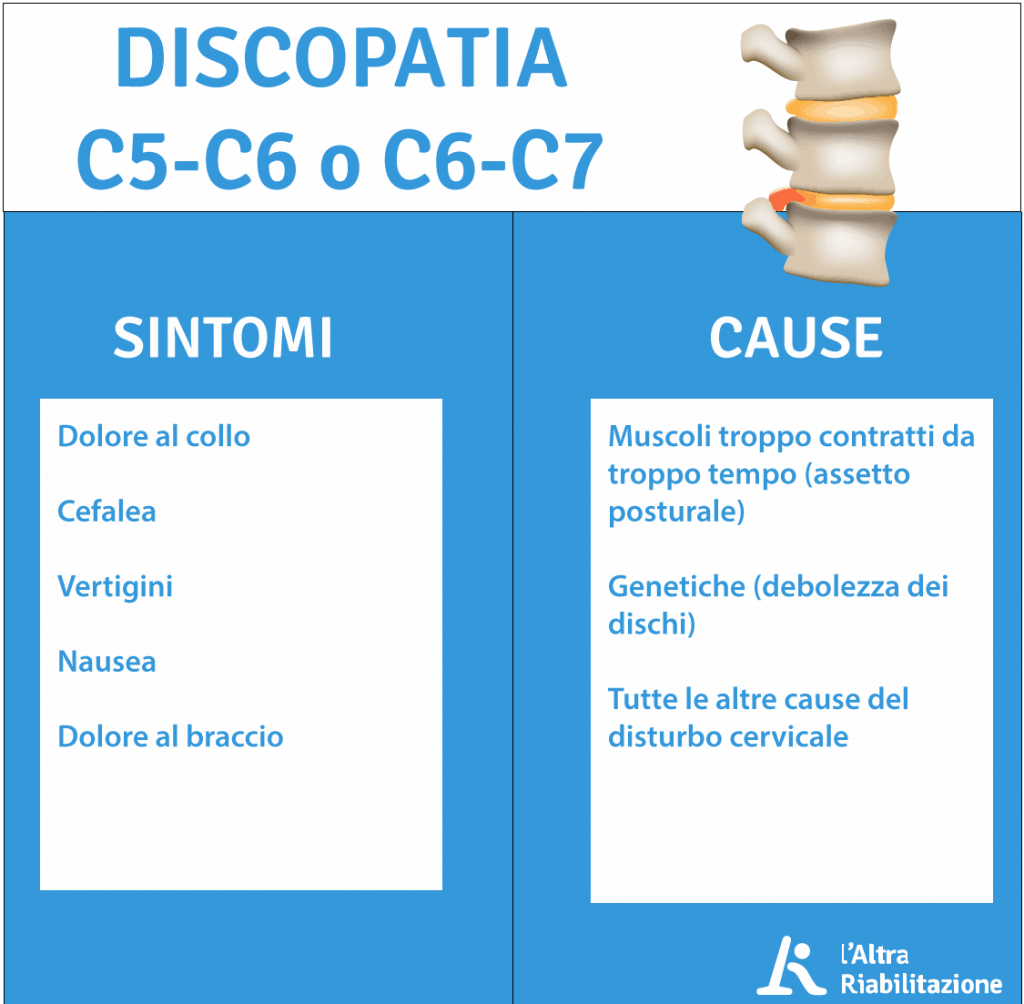 Cos'è e cosa fare se hai una protrusione (o discopatia) C5C6 o C6C7 L'Altra Riabilitazione Cos'è e cosa fare se hai una protrusione (o discopatia) C5C6 o C6C7 L'Altra Riabilitazione