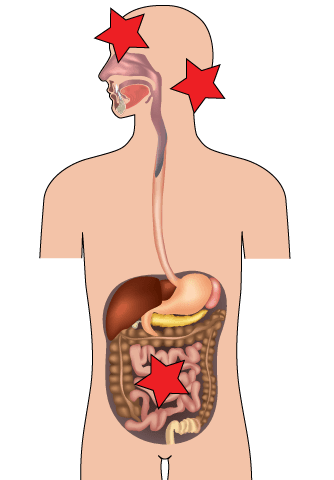 Intestino e mal di testa