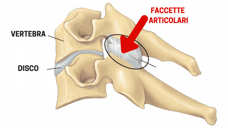 faccette articolari