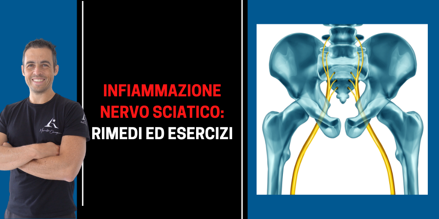Infiammazione nervo sciatico: rimedi ed esercizi