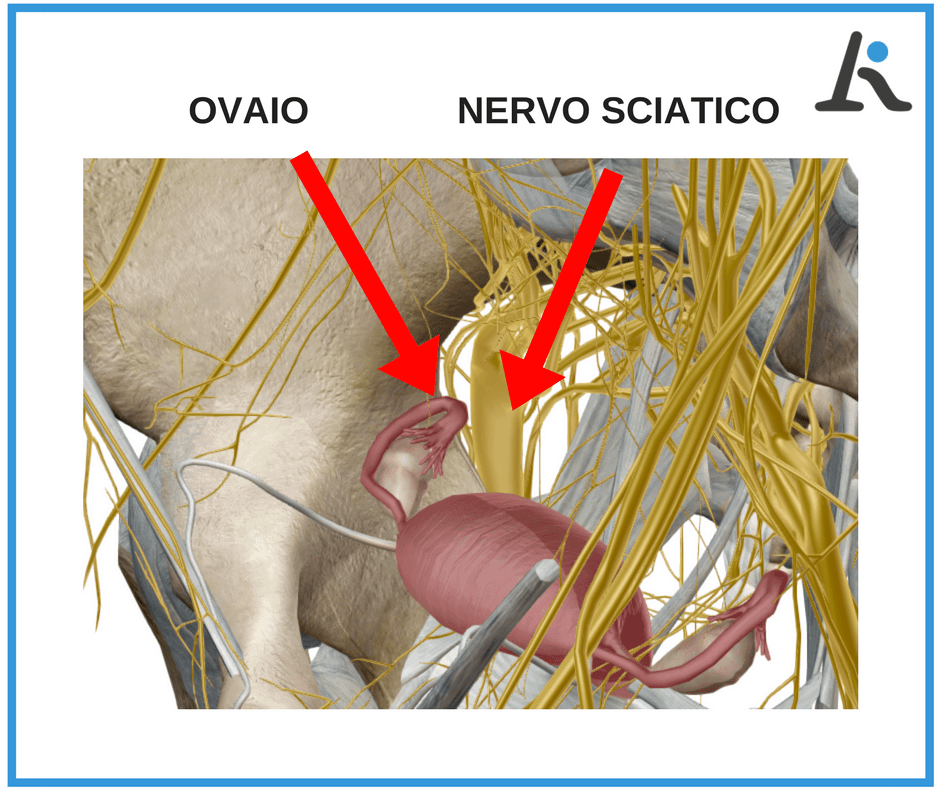 Infiammazione nervo sciatico