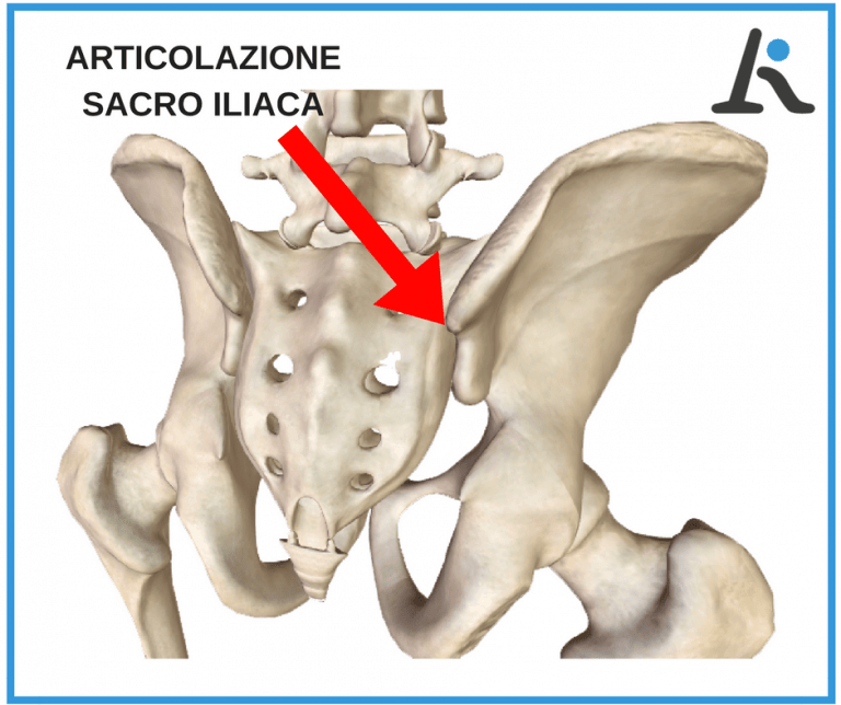 Infiammazione sacro iliaca