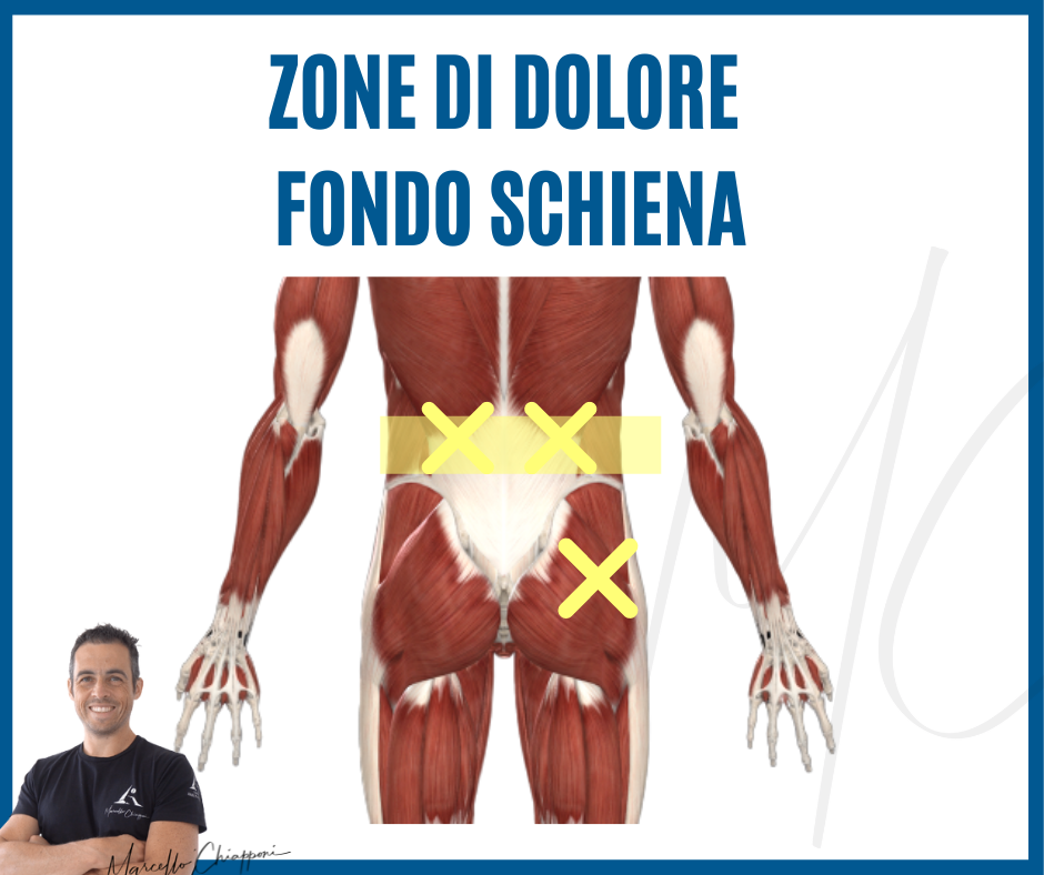 dolore fondo schiena