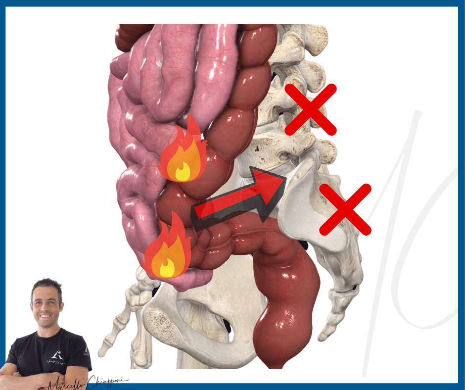 intestino e dolore fondo schiena