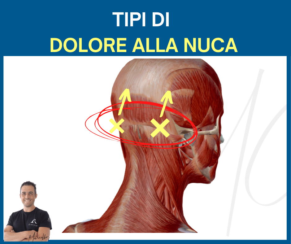 Dolore alla nuca