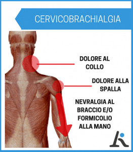 Cervicobrachialgia