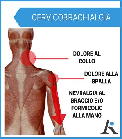 CERVICOBRACHIALGIA: scopri i 5 SINTOMI tipici + 3 ESERCIZI efficaci per curarla