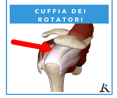 Dolore cuffia dei rotatori
