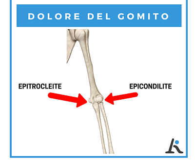 Dolore del gomito