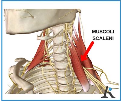 Contrattura muscoli scaleni