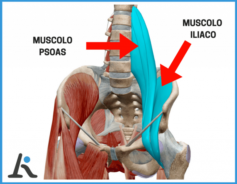 Ileo psoas