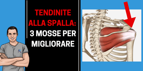 Come sconfiggere la tendinite alla spalla in 3 mosse