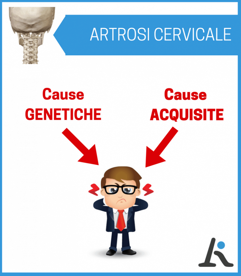 Artrosi cervicale: cause genetiche e cause acquisite