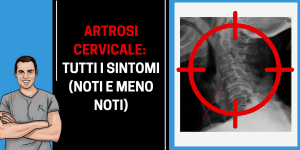 I sintomi dell'artrosi cervicale
