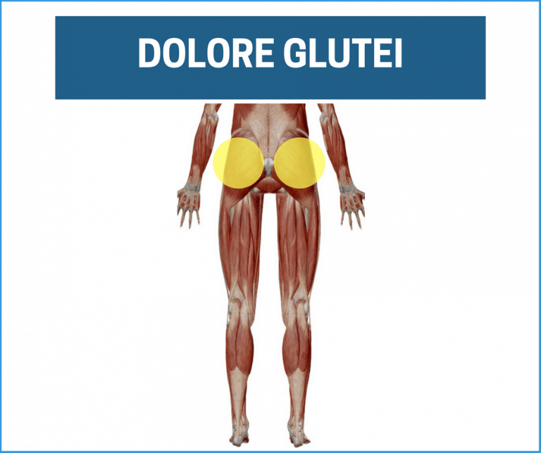 Dolore glutei