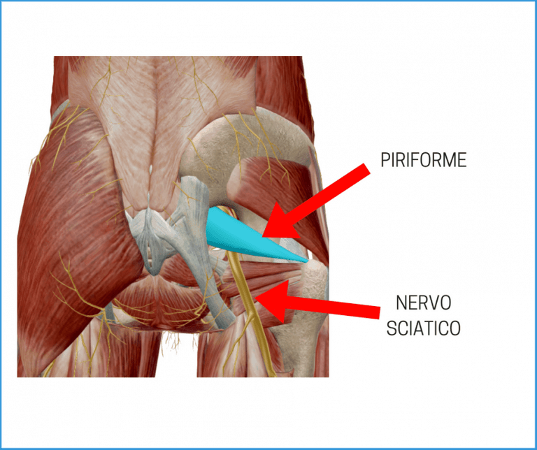 Piriforme