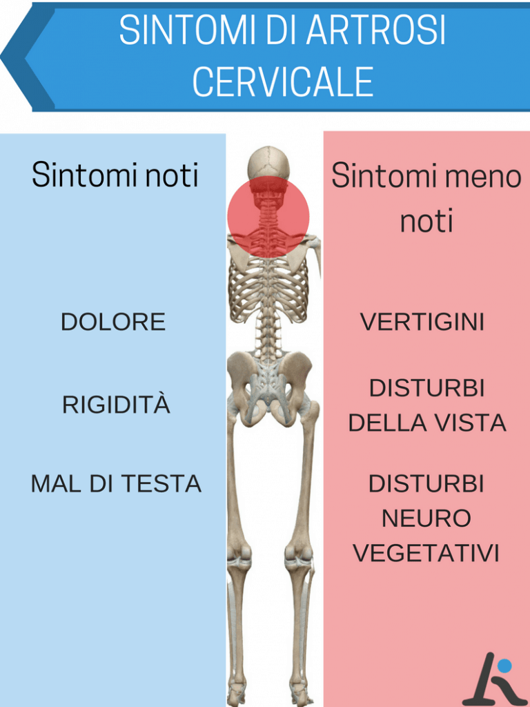 Sintomi artrosi cervicale