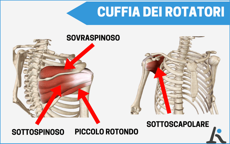 periartrite cronica semplice