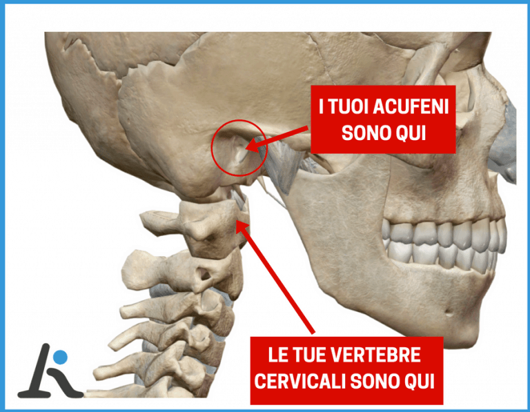 I Tuoi Acufeni Partono Dalla Cervicale Scoprilo Con 2 Test