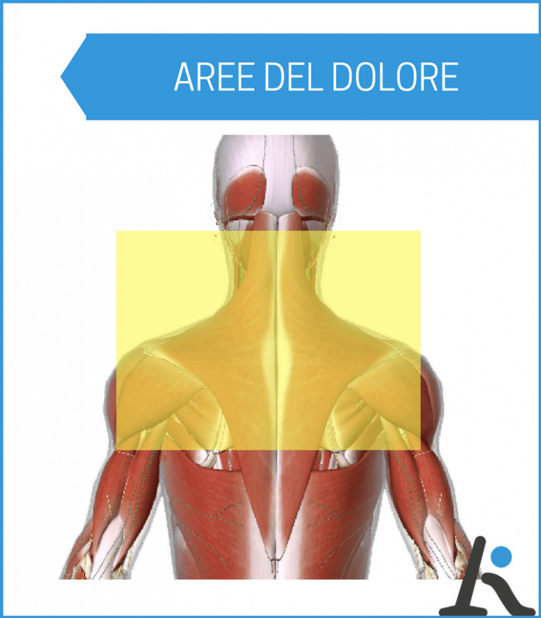 Dolore alle spalle