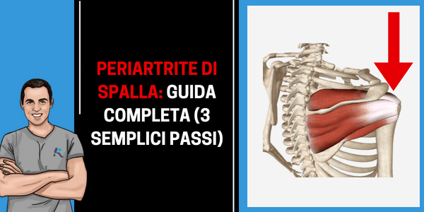 Come sconfiggere la periartrite scapolo omerale in 3 semplici passi