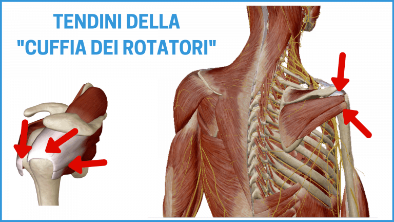 periartrite cronica semplice