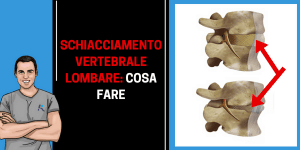 Schiacciamento vertebre lombare