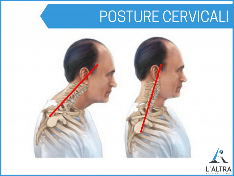 Ginnastica posturale cervicale