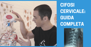 Cifosi cervicale