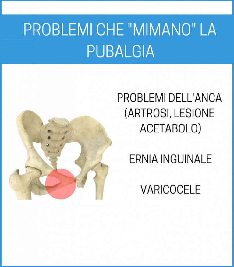 pubalgia