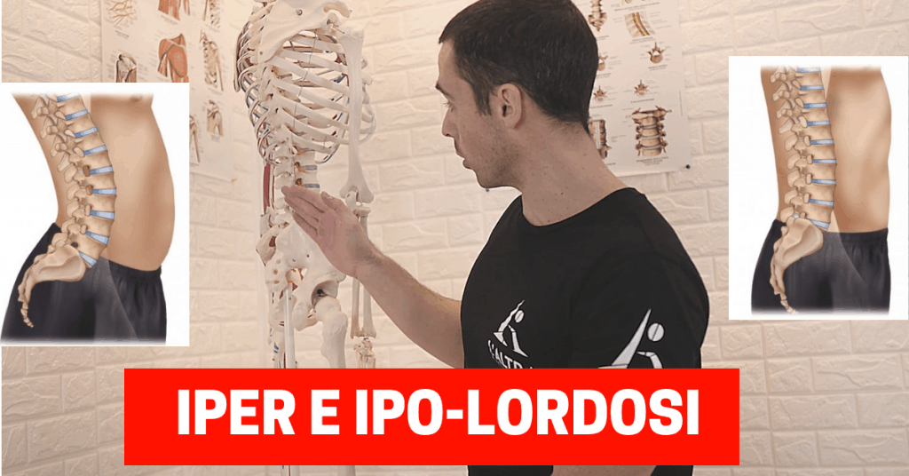 Migliora la postura della schiena: esercizi per IPO e IPER lordosi lombare