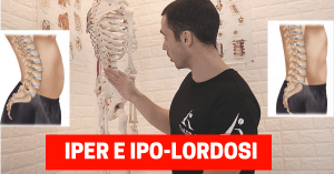 ipolordosi e iperlordosi lombare