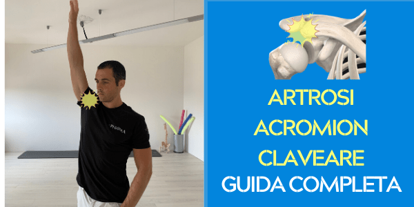 Cosa fare se hai ARTROSI ACROMION CLAVEARE