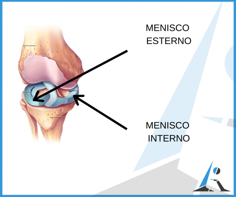 Menisco interno cosa fare se hai una lesione o una meniscosi L'Altra Riabilitazione