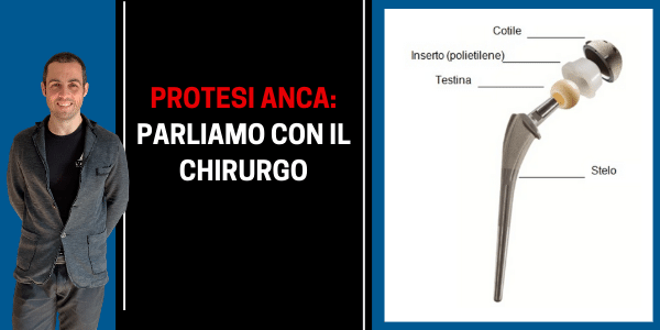 Operazione per artrosi dell'anca: la protesi è indispensabile?