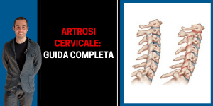 Artrosi cervicale