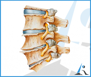 Artrosi cervicale