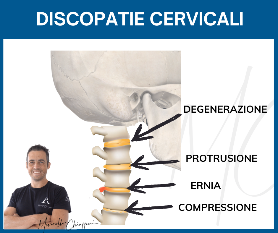 discopatie cervicali