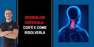 Spondilosi cervicale