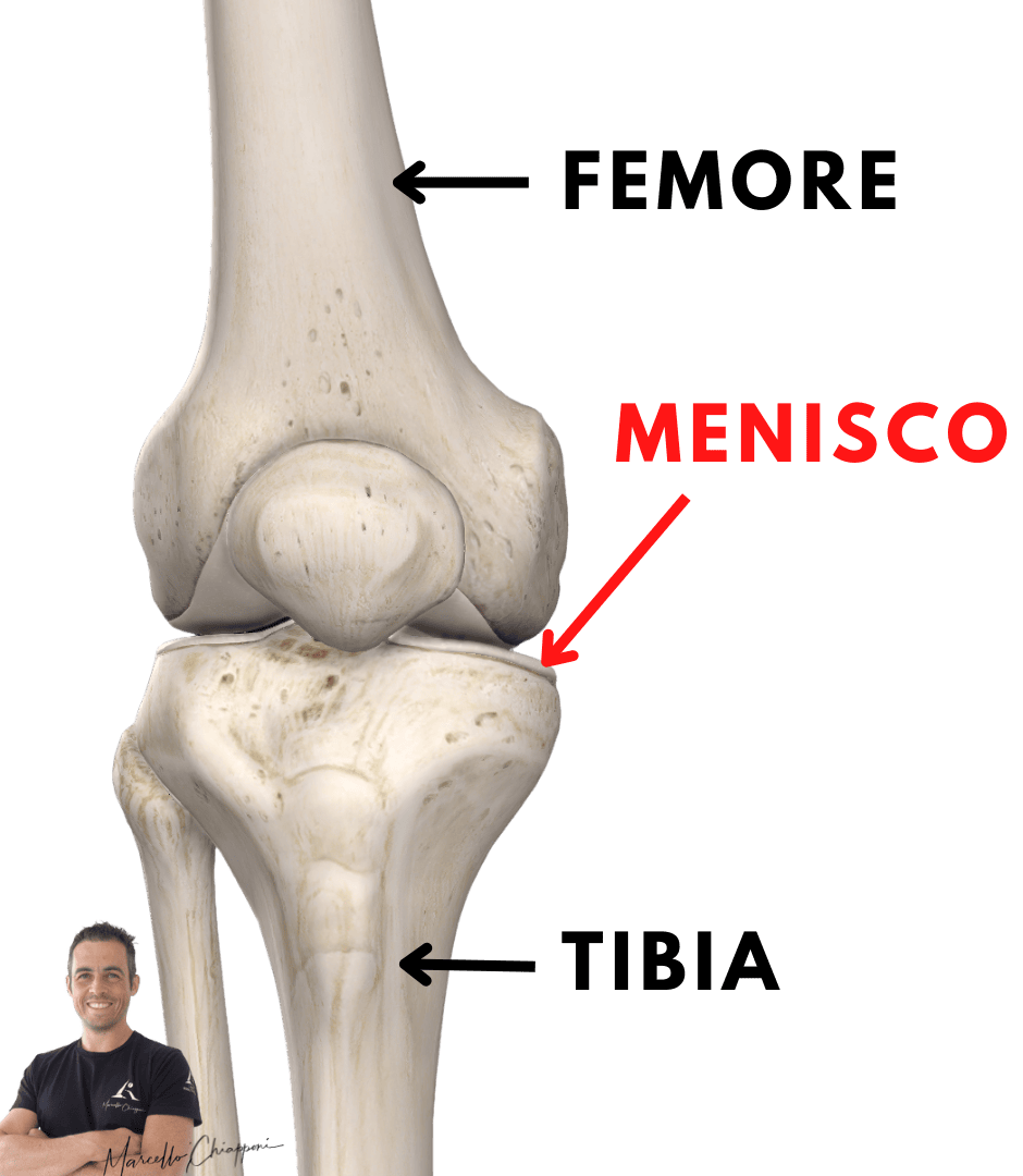 lesione menisco