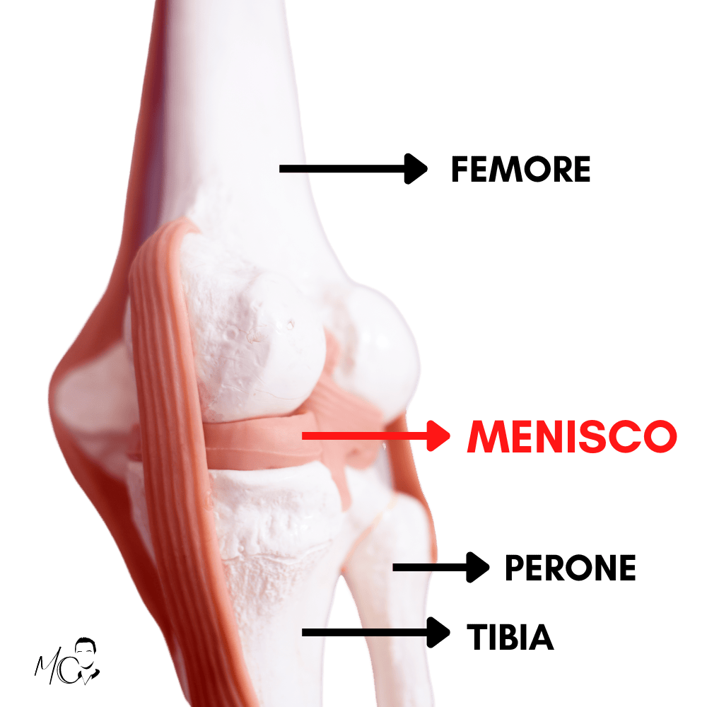 menisco infiammato